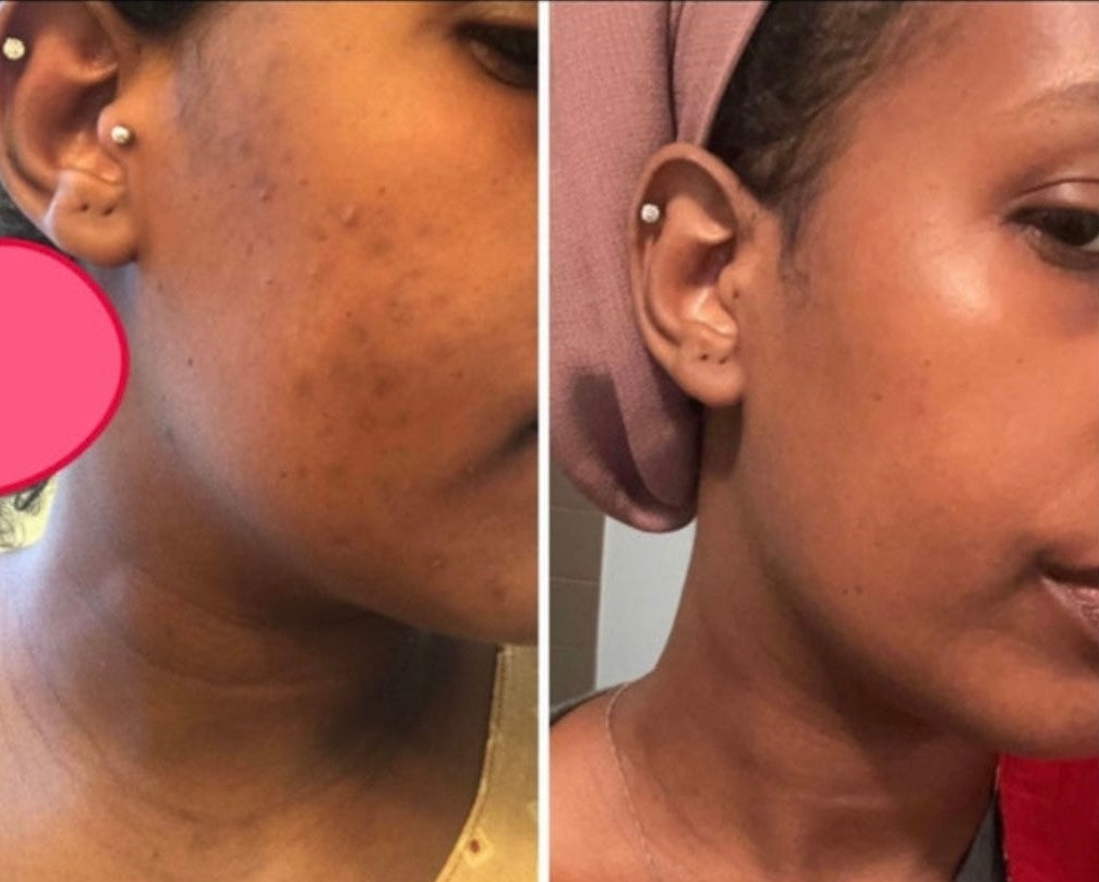 Face kit bundle